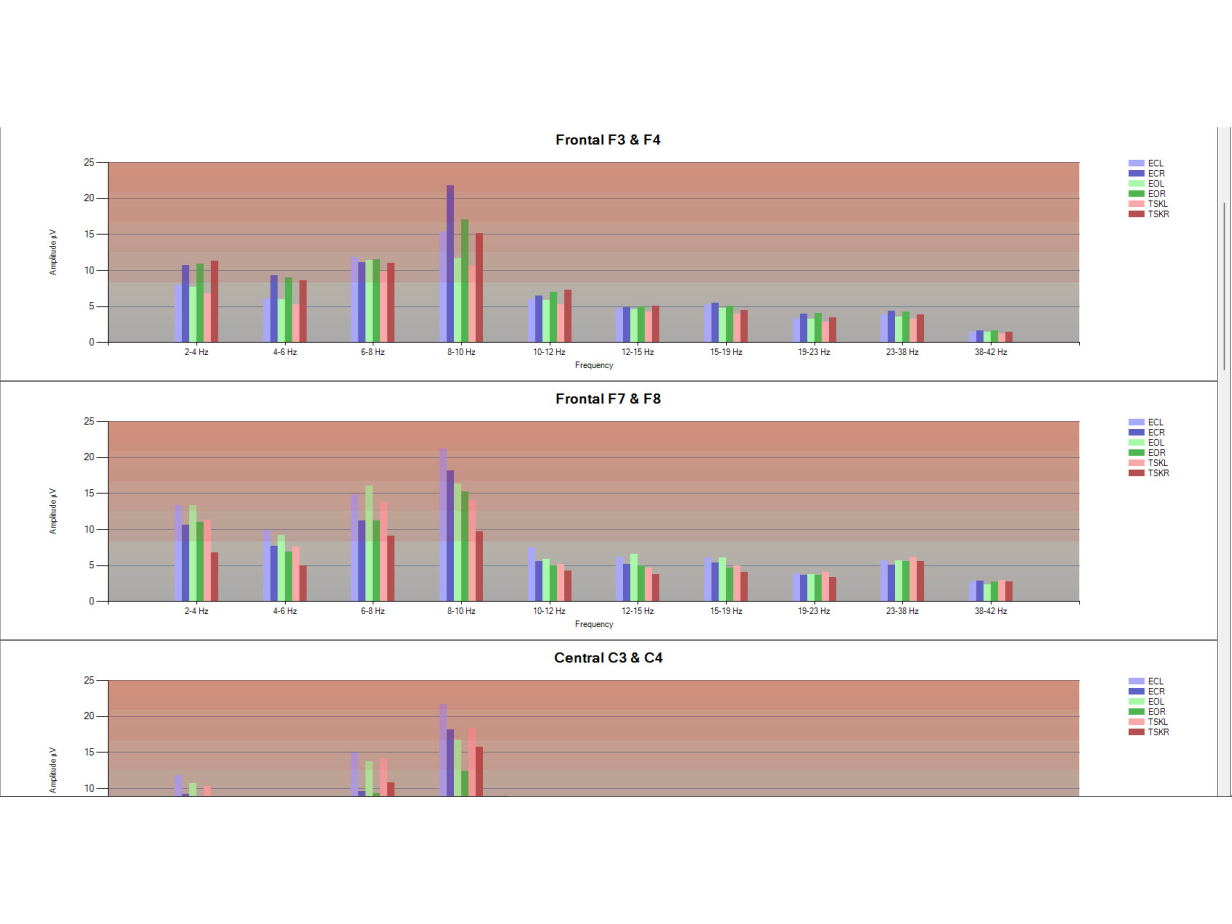 TQ8-Histo-43.png